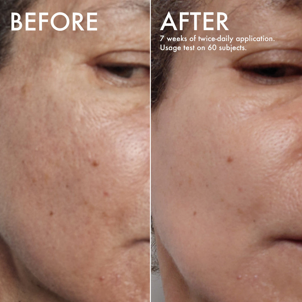 L'Odaïtès brightening serum before and after n°2