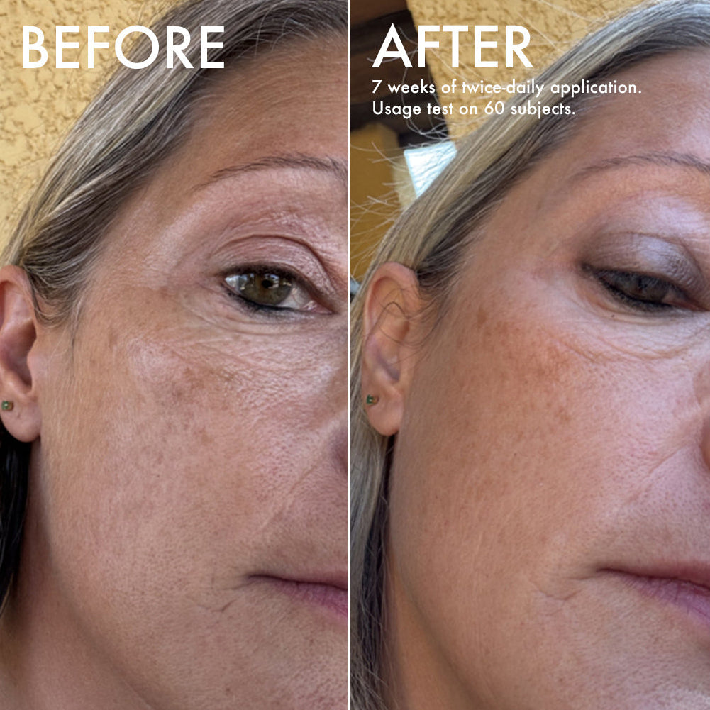 L'Odaïtès brightening serum before and after n°1