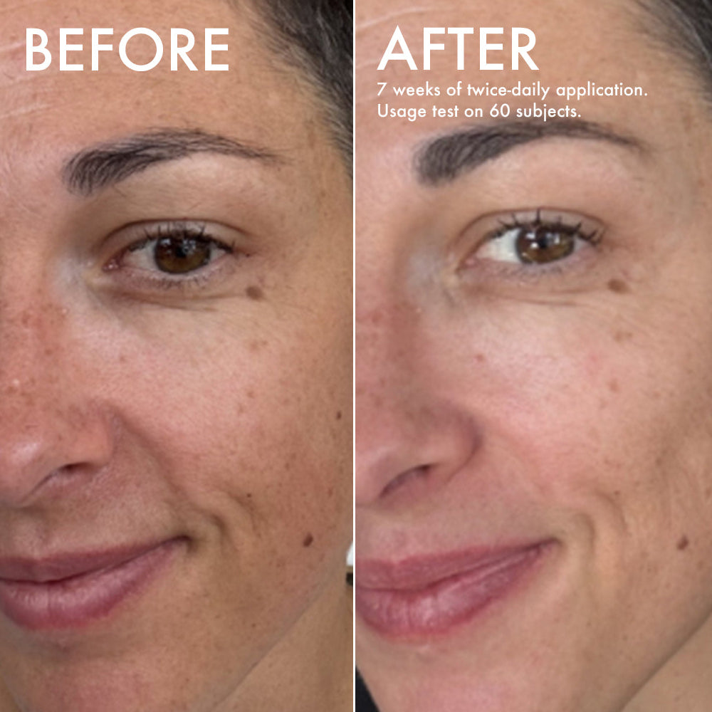 L'Odaïtès brightening serum before and after n°3